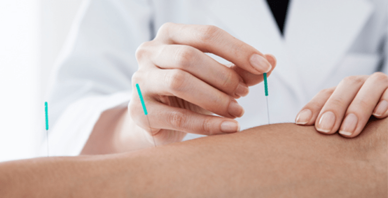 Top Reasons why you should seek Acupuncture Treatment (Demo)
