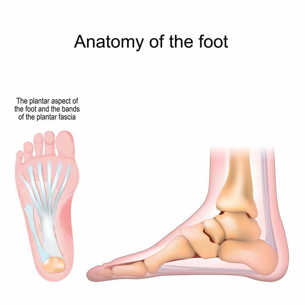 How Plantar Fasciitis Affects You Synergy